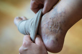 جوراب واریس Varisocks ترکیه