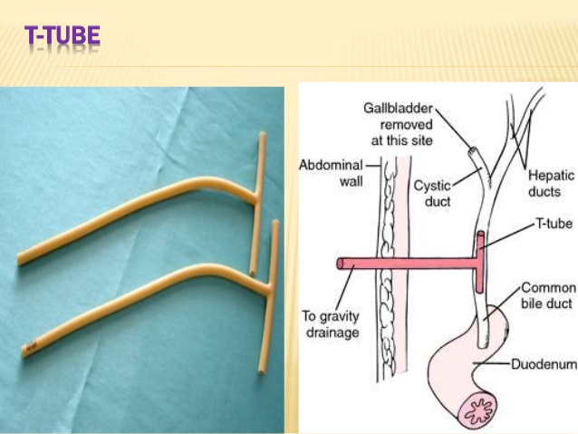 درن تی تیوب سوپا